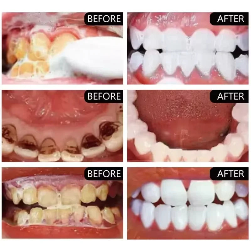 Purple Teeth Whitening Powder – Stain Remover, Fresh Breath